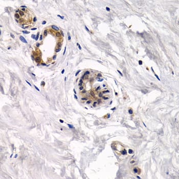 CAPN3 / Calpain 3 Antibody (AP)