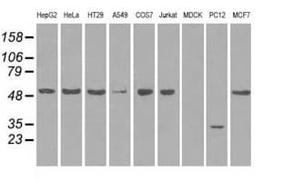 SLC2A5 / GLUT5 Antibody (clone OTI9F3, Carrier-free)