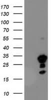 TP73-AS1 / KIAA0495 Antibody (clone OTI2C2)