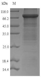 Mouse ACSS2 / ACAS2 Protein (Recombinant 6His, N-terminus)