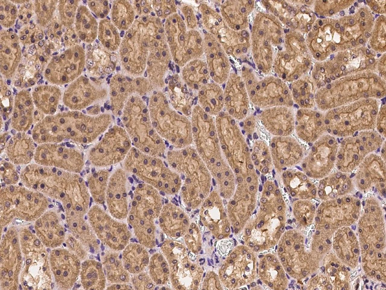 Polyclonal Rabbit anti-Human CLTC / Clathrin Heavy Chain Antibody (IHC, WB)