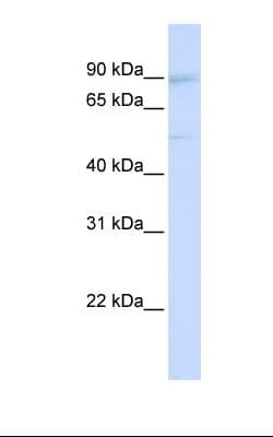UBTF / UBF Antibody (aa362-411)