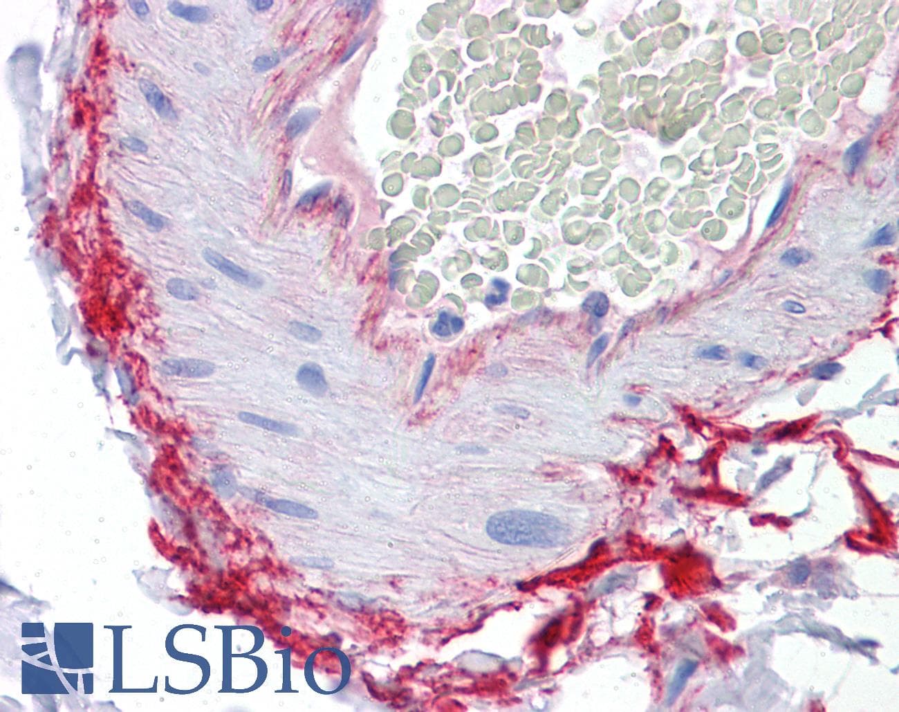 IHC-plus™ ROCK2 Antibody (clone 1E12)