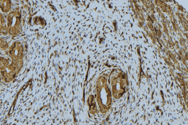 NPPA / ANP Antibody