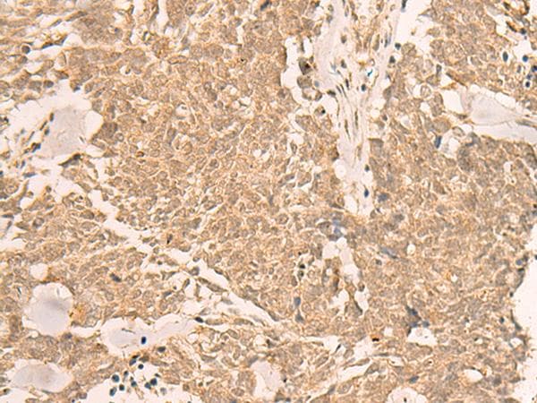 IL1RAPL2 Antibody