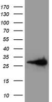 Latexin / MUM Antibody (clone OTI1E10)