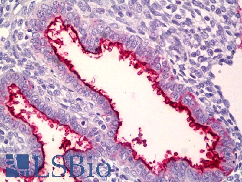 IHC-plus™ MUC16 / CA125 Antibody (aa13311-13360)