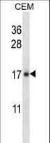 IL21 Antibody (aa104-132)