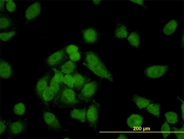 NCAPD2 Antibody (clone 4C12)