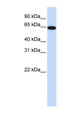 NR2C2 / TAK1 Antibody (aa36-85)