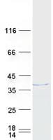Human HNRNPH3 / hnRNP H3 Protein (Recombinant Myc-DDK (Flag))