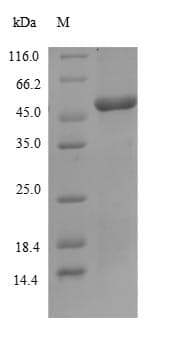 Human SLURP1 / ARS / MDM Protein (Recombinant)