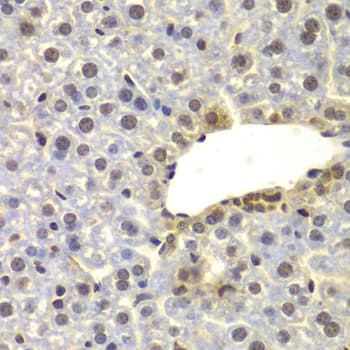 Polyclonal Rabbit anti-Human FAM48A / P38IP Antibody (IHC, IF, WB)