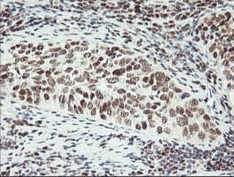 ERCC1 Antibody (clone 2.00E+12)