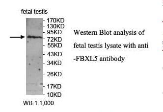 IHC-plus™ FBXL5 / FBL5 Antibody (aa510-691)