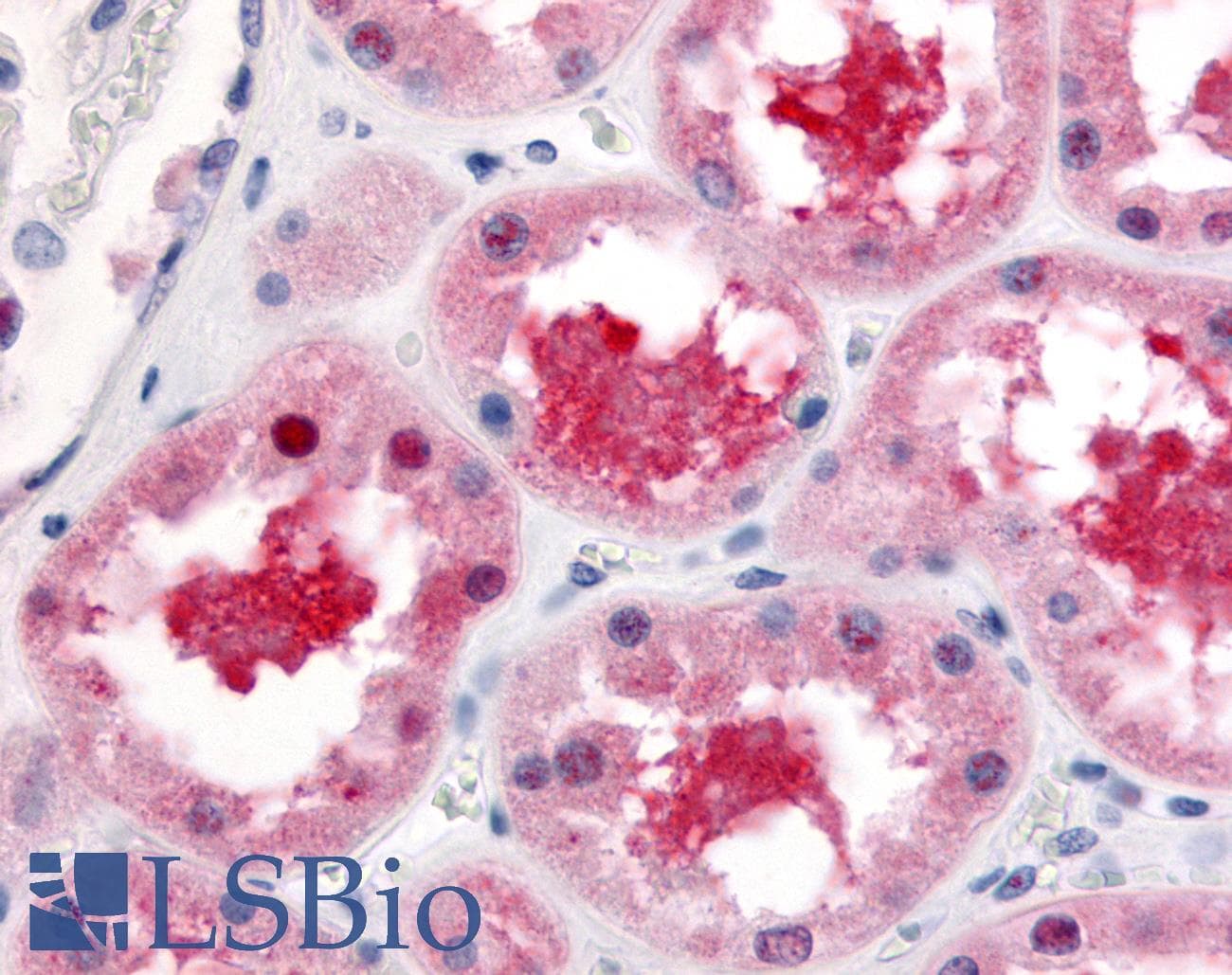 IHC-plus™ ABCB1 / MDR1 / P Glycoprotein Antibody (Cytoplasmic Domain)