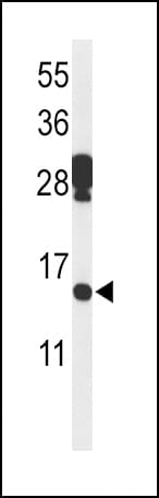 Polyclonal Rabbit anti-Human PDCD5 Antibody (aa1-30, WB)