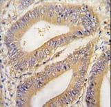 Polyclonal Rabbit anti-Human Prohibitin 2 / PHB2 Antibody (aa66-95, IHC, WB)