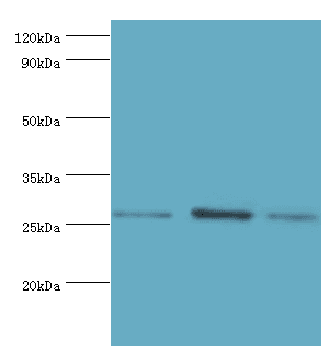 Polyclonal Rabbit anti-Human AZU1 / Azurocidin Antibody (aa27-251, IHC, WB)
