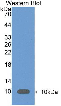 Complement C5 Antibody