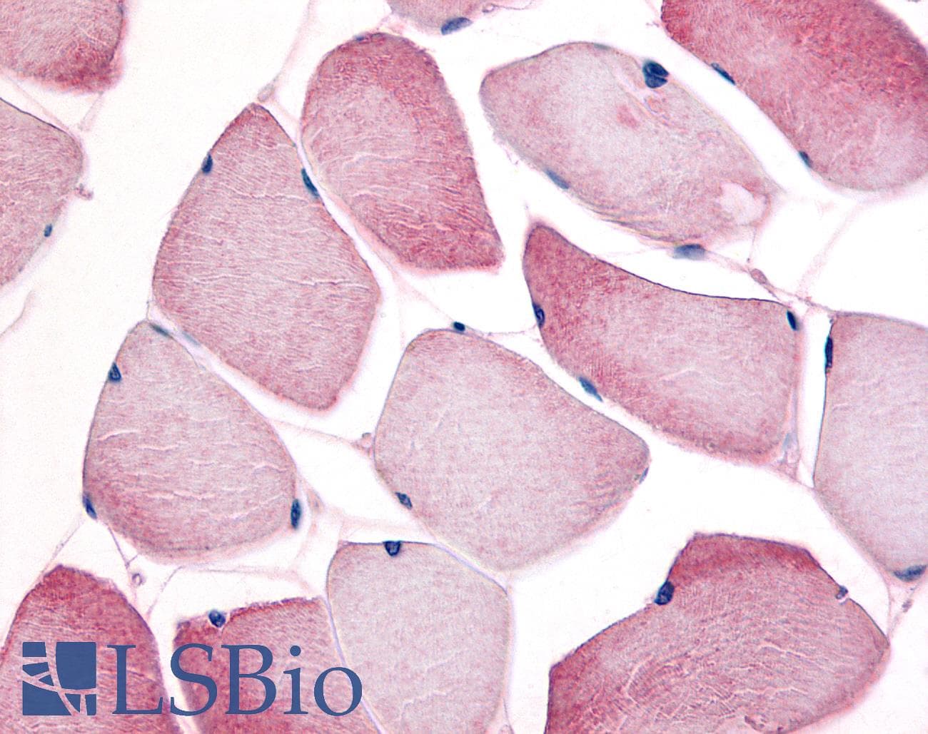 IHC-plus™ Polyclonal Rabbit anti-Human CCNL1 / Cyclin L1 Antibody (IHC, WB)