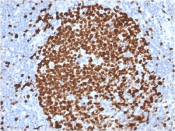 MKI67 / Ki67 Antibody (clone MKI67/2465)
