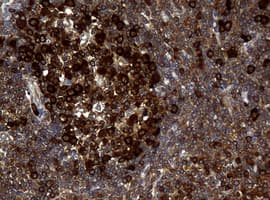 NME1 / NM23 Antibody (clone OTI3F2, Carrier-free)