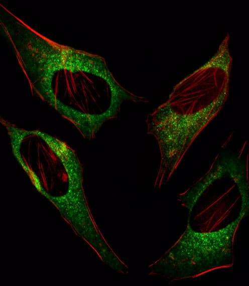 DDIT3 / CHOP Antibody (aa120-149)