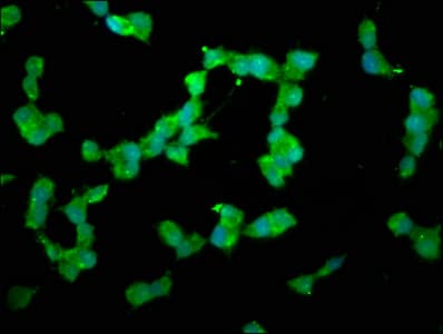 Polyclonal Rabbit anti-Human DUSP26 / MKP8 Antibody (aa1-211, IHC, WB)