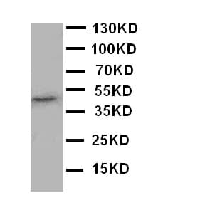 MAPK8 / JNK1 Antibody (aa1-15)
