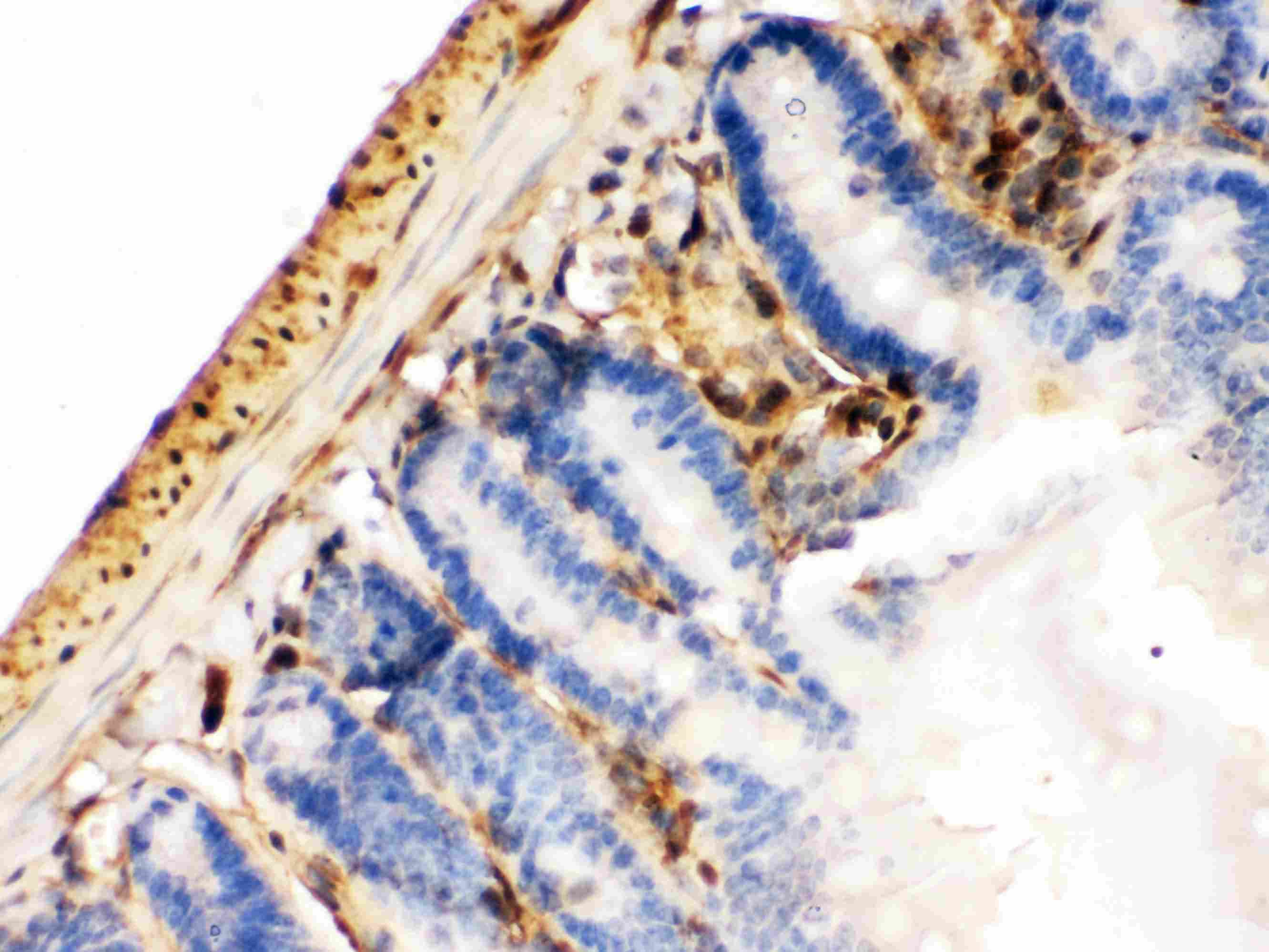 LGALS1 / Galectin 1 Antibody