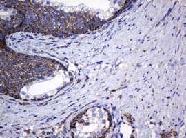 HSPD1 / HSP60 Antibody (clone OTI6F11, Carrier-free)