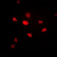 Polyclonal Rabbit anti-Human PR / Progesterone Receptor Antibody (Internal, IHC, IF, WB)