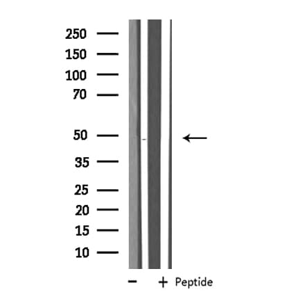 SLC16A14 / MCT14 Antibody