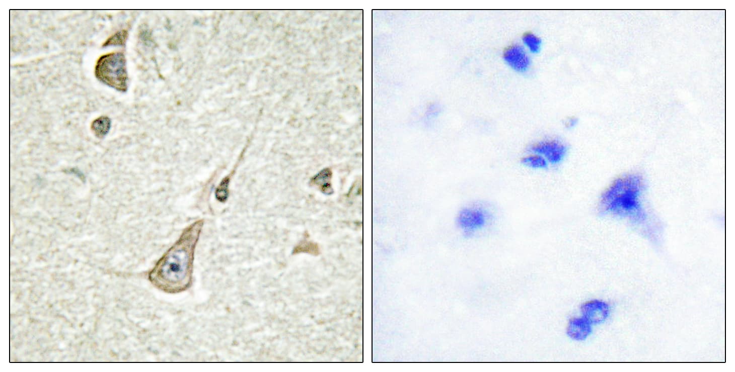 PCDH11X+Y Antibody (aa531-580)