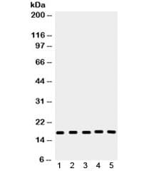 Polyclonal Rabbit anti-Human CASP2 / Caspase 2 Antibody (WB)