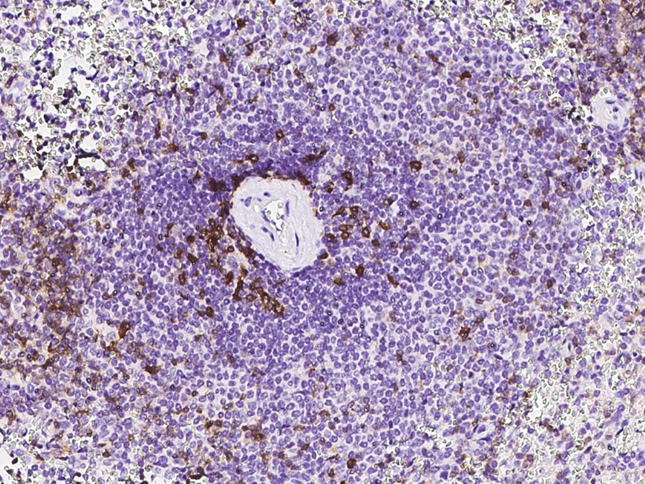 Monoclonal Mouse anti-Human PDCD1 / CD279 / PD-1 Antibody (clone 23, Preservative Free, IHC)