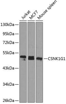 Polyclonal Rabbit anti-Human CSNK1G1 / CKI-Gamma 1 Antibody (WB)