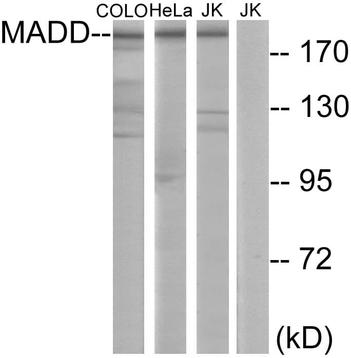 DENN / MADD Antibody (aa751-800)