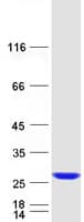 Human RAB38 Protein (Recombinant Myc-DDK (Flag))