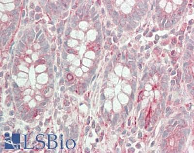 IHC-plus™ Polyclonal Rabbit anti-Human ABCB10 Antibody (Internal, IHC, IF, WB)