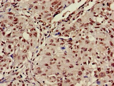 HIST1H3A Antibody