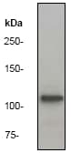IHC-plus™ ADD1 / Adducin Alpha Antibody (C-Terminus, clone EP734Y)