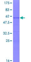 Human SSX1 Protein (Recombinant GST)