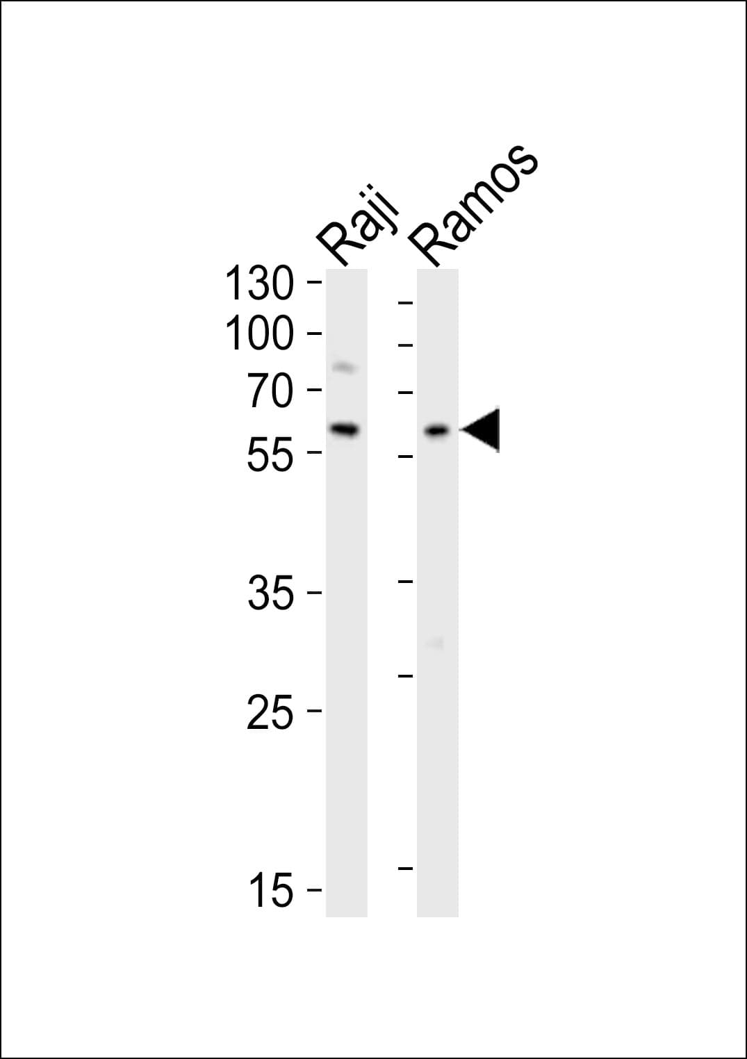 Polyclonal Rabbit anti-Human LYN Antibody (aa43-77, WB)