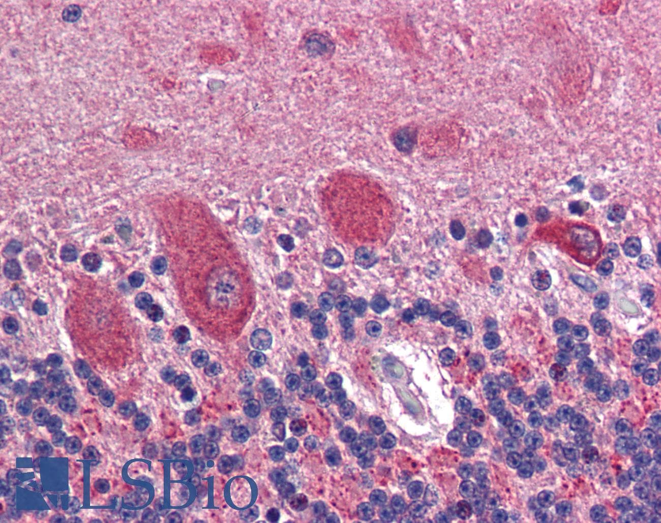 IHC-plus™ Polyclonal Goat anti-Human GAD65 Antibody (aa515-528, IHC, WB)