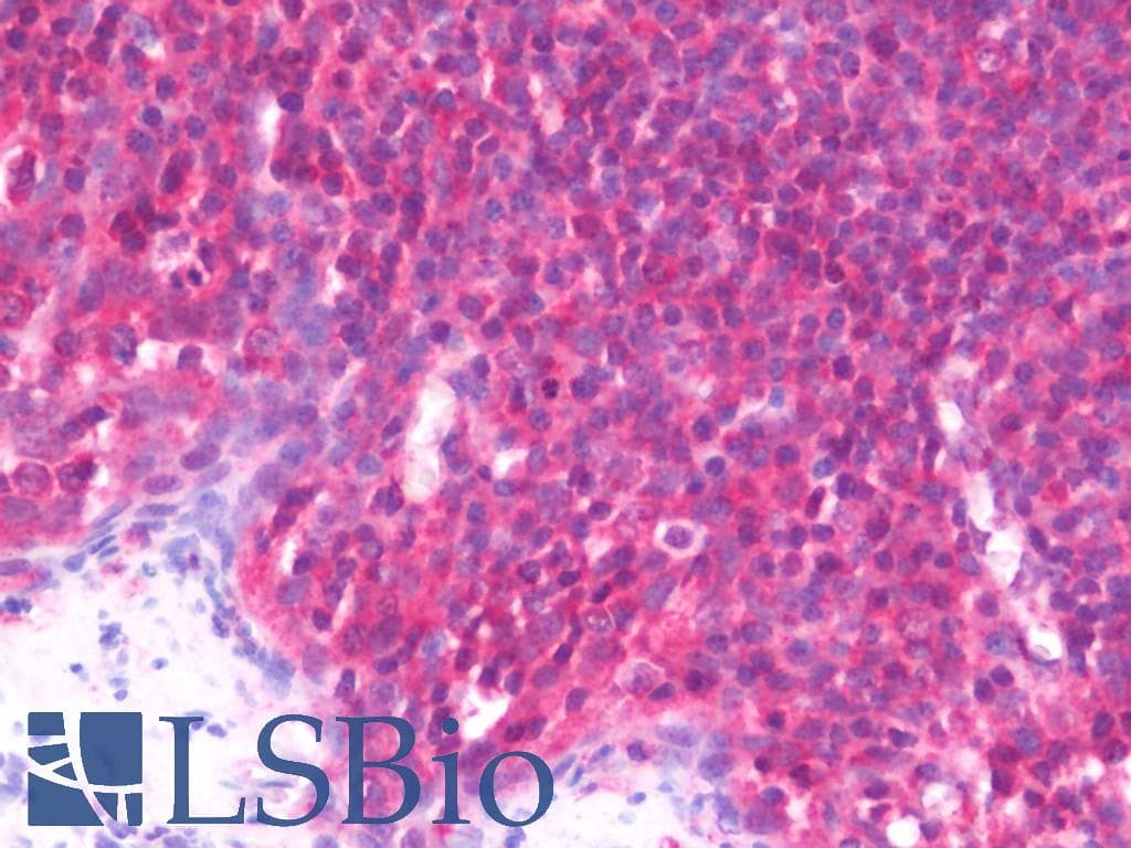 IHC-plus™ Polyclonal Rabbit anti-Human PCMT1 Antibody (aa10-227, IHC, WB)