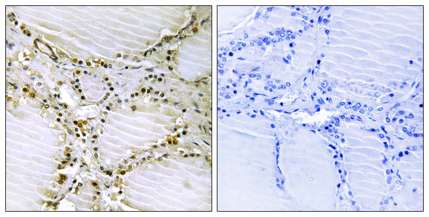 AMPD1 Antibody (aa261-310)
