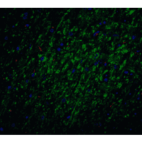BIRC5 / Survivin Antibody