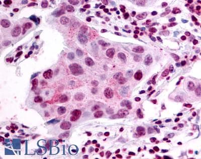 IHC-plus™ SIPR2 / S1P2 / EDG5 Antibody (Cytoplasmic Domain)